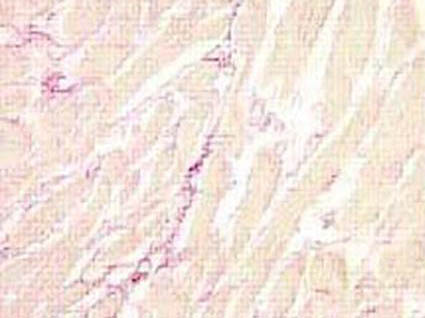 器官纖維化產生的細胞與分子基礎
